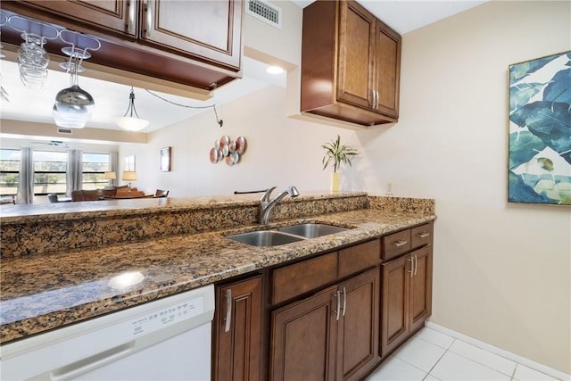 kitchen with dark stone counters, dishwasher, sink, and light tile patterned floors