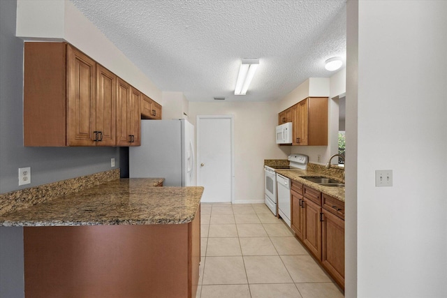 kitchen with dark stone counters, a textured ceiling, white appliances, sink, and light tile patterned flooring