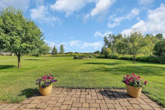 view of property's community with a lawn