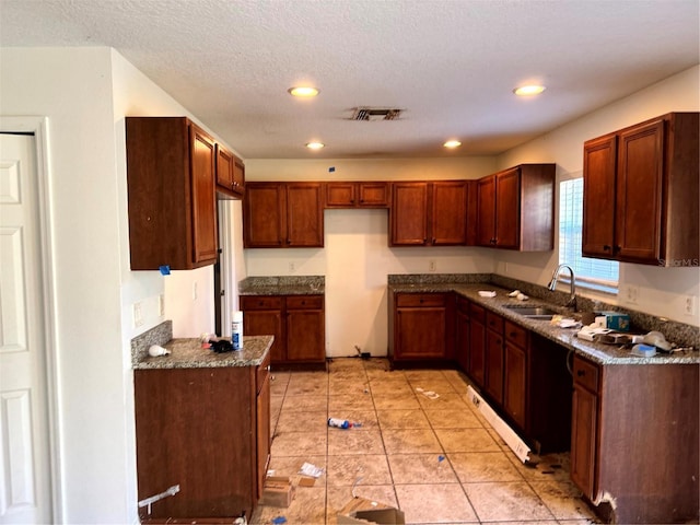 kitchen with dark stone countertops, sink, light tile patterned flooring, and a textured ceiling