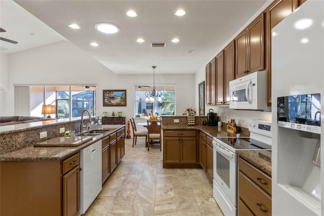 kitchen with a peninsula, white appliances, a sink, visible vents, and dark stone counters