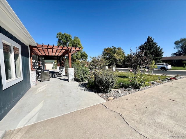 view of patio featuring a pergola