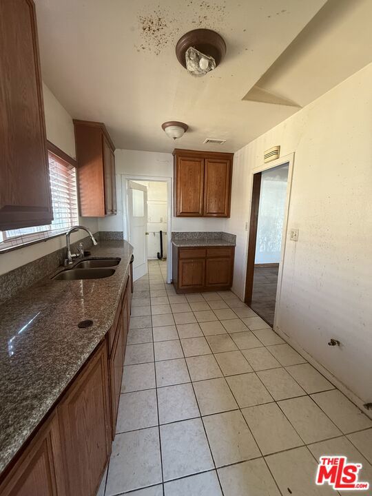 kitchen featuring sink, light tile patterned floors, and dark stone counters