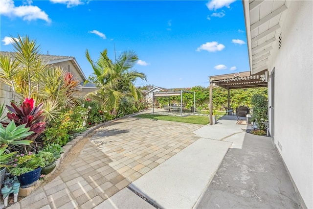 view of patio featuring a pergola