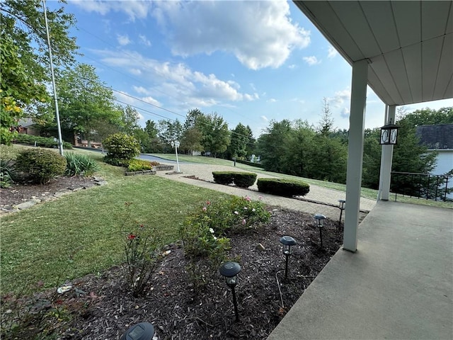 view of property's community with a lawn