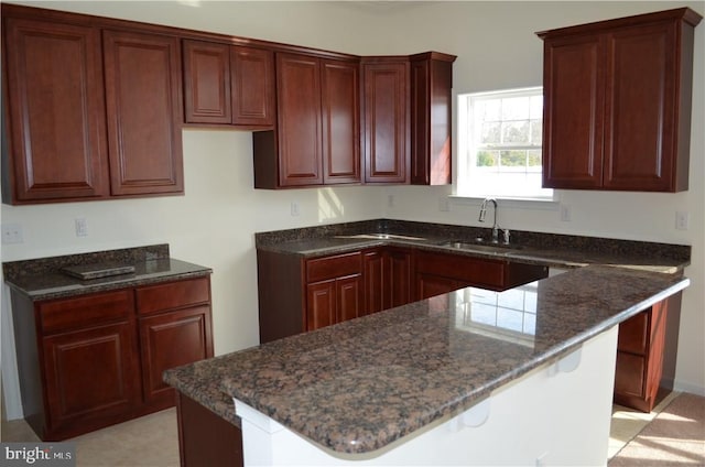 kitchen with sink and dark stone counters