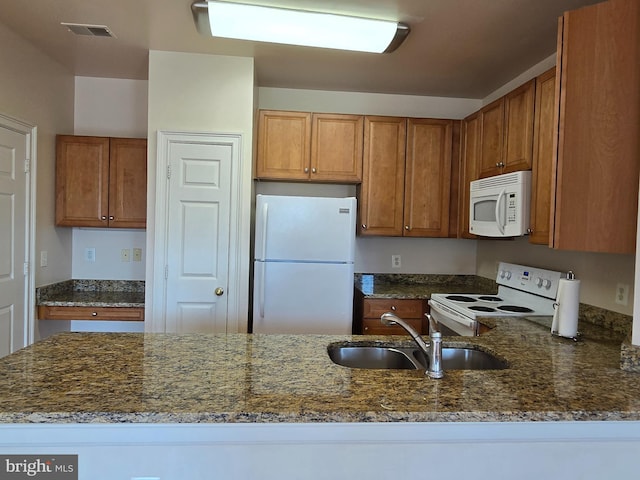 kitchen with white appliances, dark stone countertops, and sink