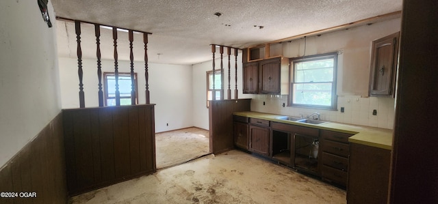 kitchen with a textured ceiling, sink, and dark brown cabinetry