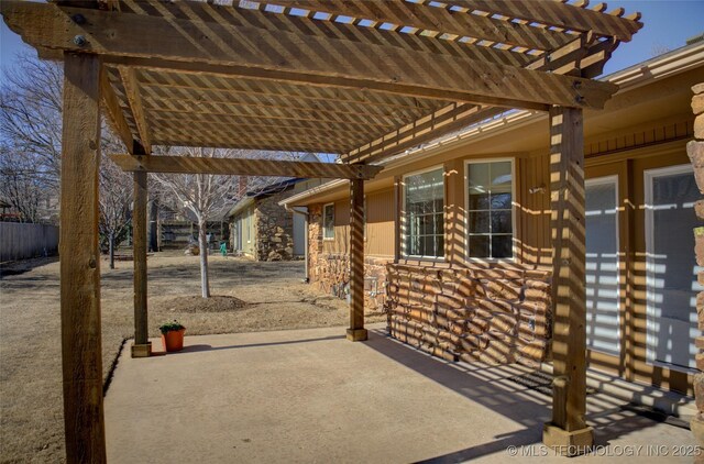 view of patio featuring a pergola