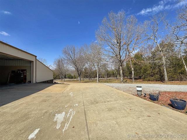 view of yard featuring a garage and an outdoor structure