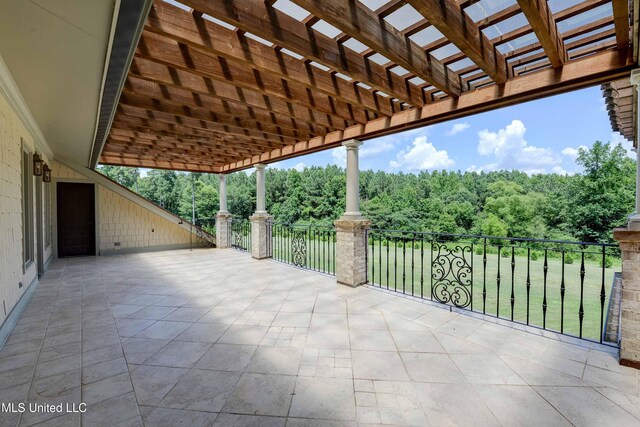 11281 Rd 468, Philadelphia, MS 39350 - view of patio featuring a pergola
